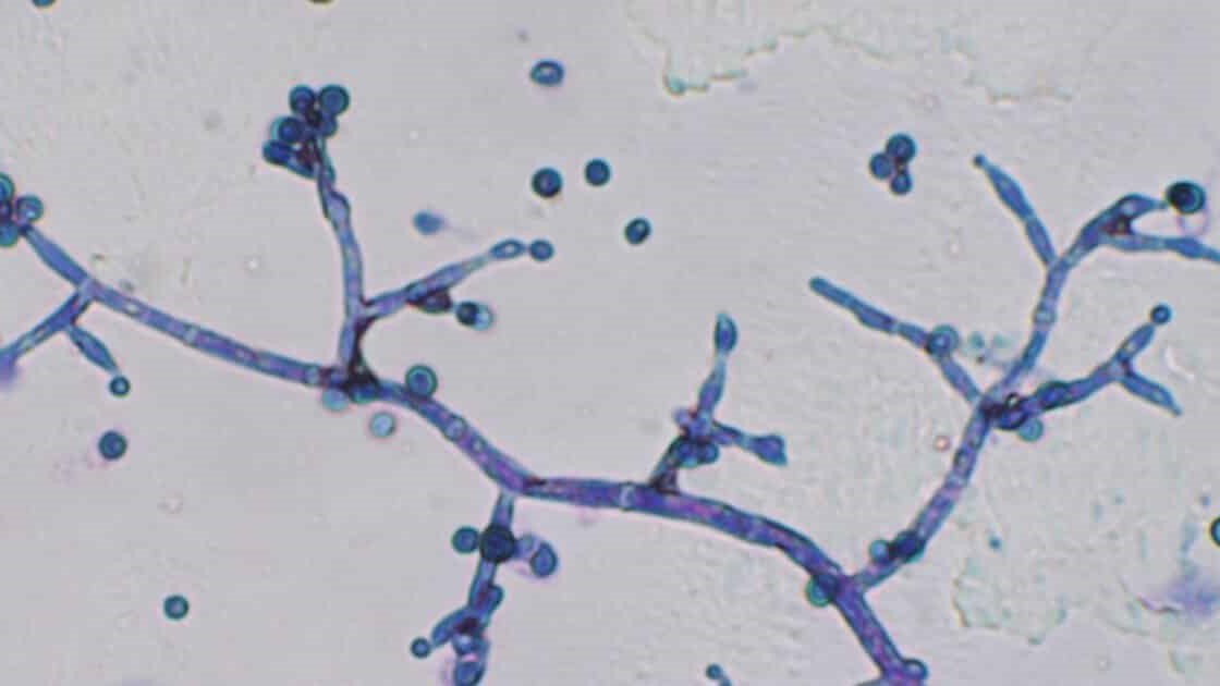 Efectos positivos de la aplicación de Trichoderma a semillas de pepino